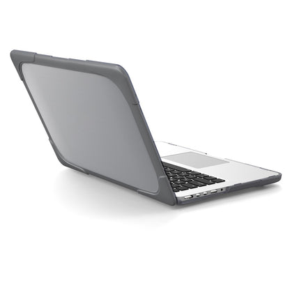 Hard PC Laptop Case Notebook Computer Cover with Supporting Stand Feet for MacBook Pro 15-inch / Pro Retina 15-inch A1398