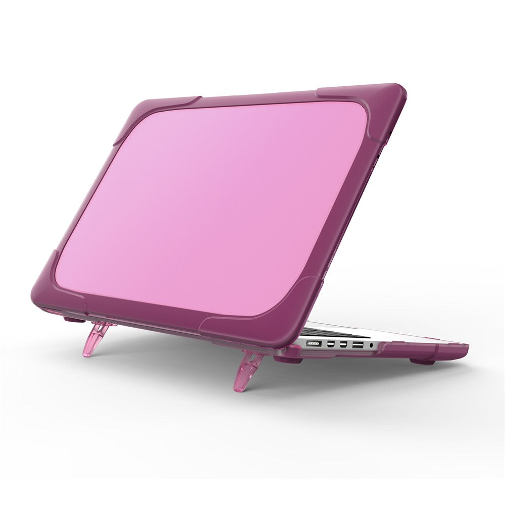 Hard PC Laptop Case Notebook Computer Cover with Supporting Stand Feet for MacBook Pro 15-inch / Pro Retina 15-inch A1398