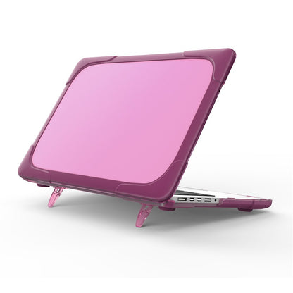 Hard PC Laptop Case Notebook Computer Cover with Supporting Stand Feet for MacBook Pro 15-inch / Pro Retina 15-inch A1398